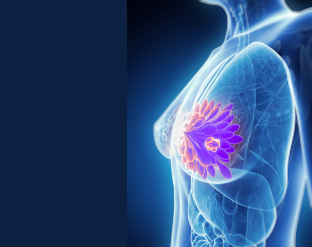 Equipe et parcours de soins à la Clinique du Sein